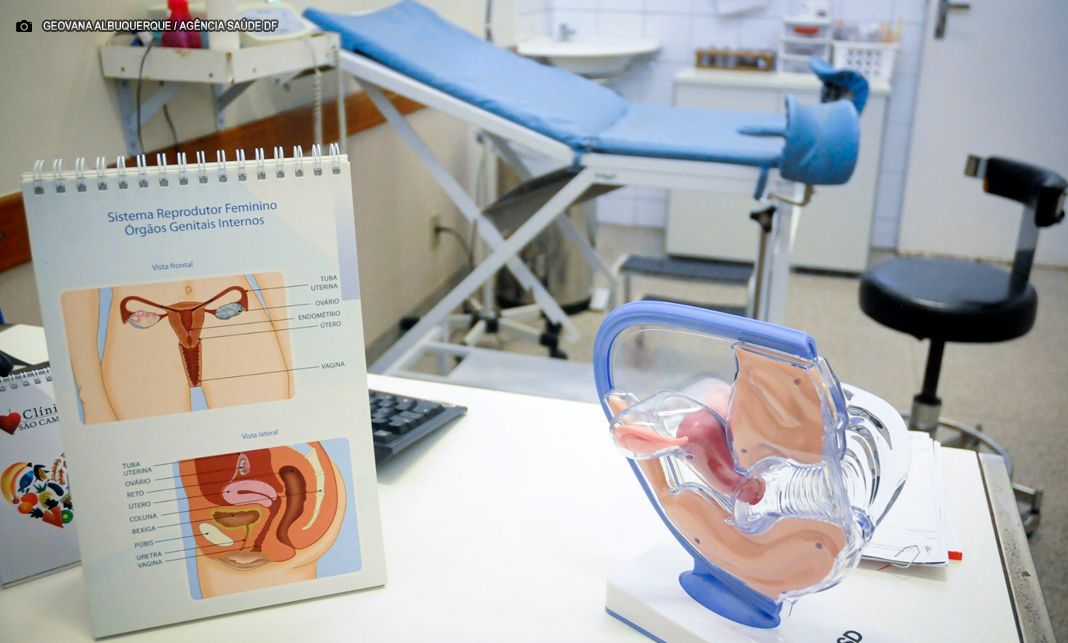 Laqueadura: Veja como acessar o serviço na rede pública do DF