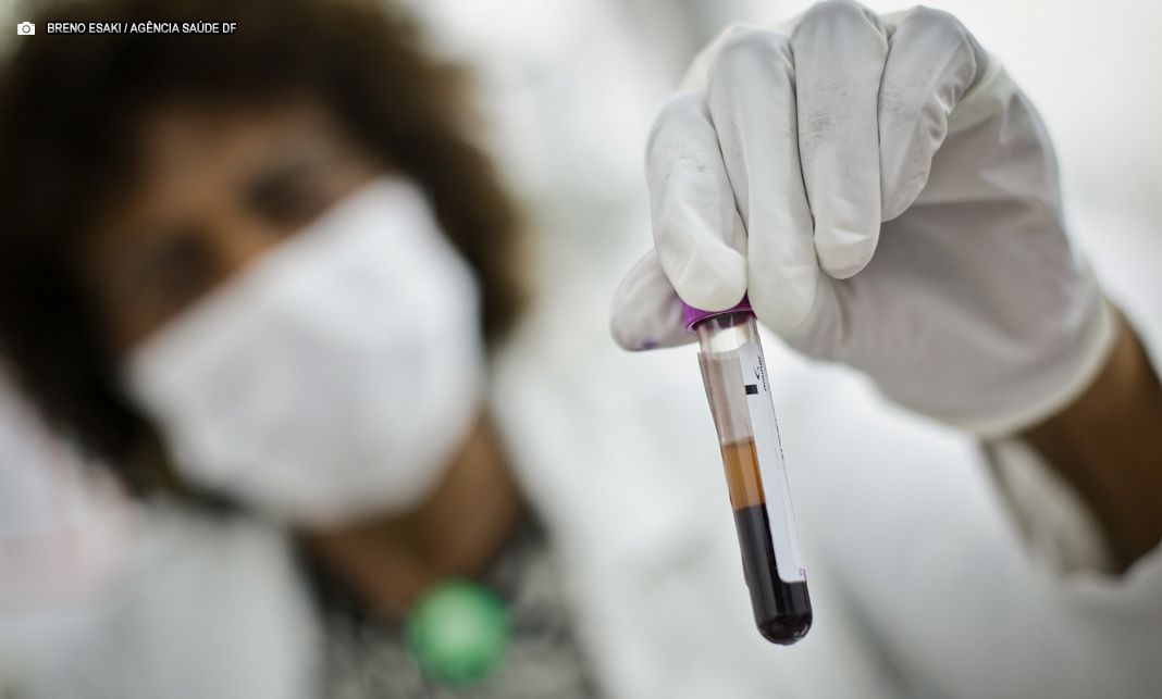 Secretaria de Saúde oferta amplo diagnóstico e tratamento para leucemias