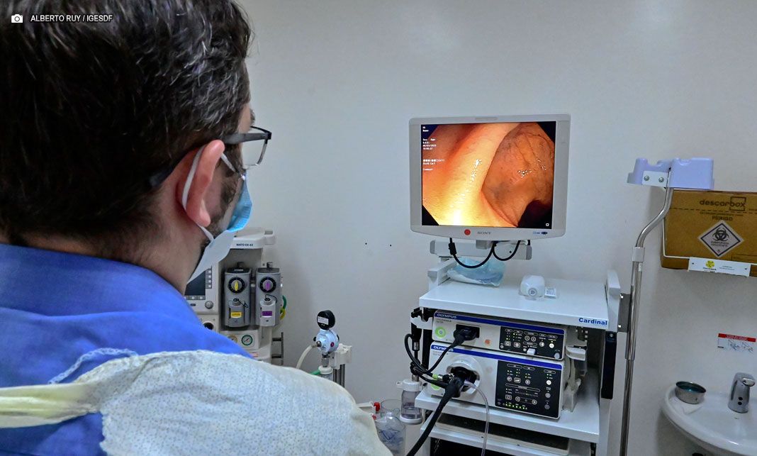 Sociedade Brasileira de Endoscopia Digestiva do DF organiza mutirão de colonoscopia no Hospital de Base