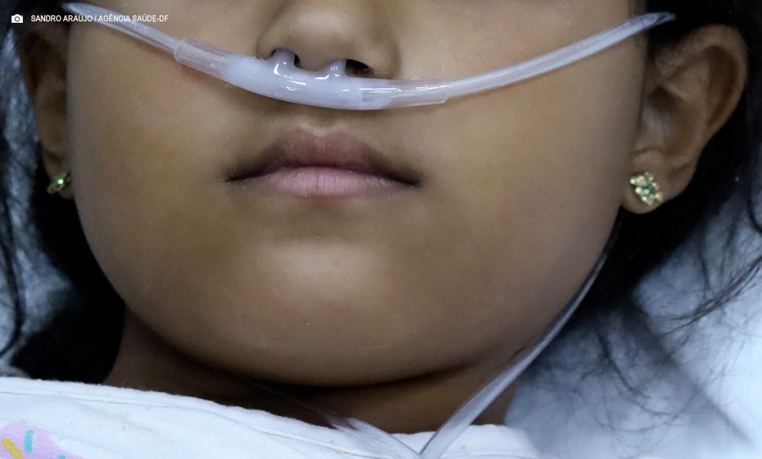 Novos cateteres nasais de alto fluxo reforçam atendimento pediátrico na rede pública