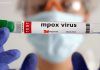 Brasil confirma 88 casos de Mpox em 2026; São Paulo concentra maioria das infecções