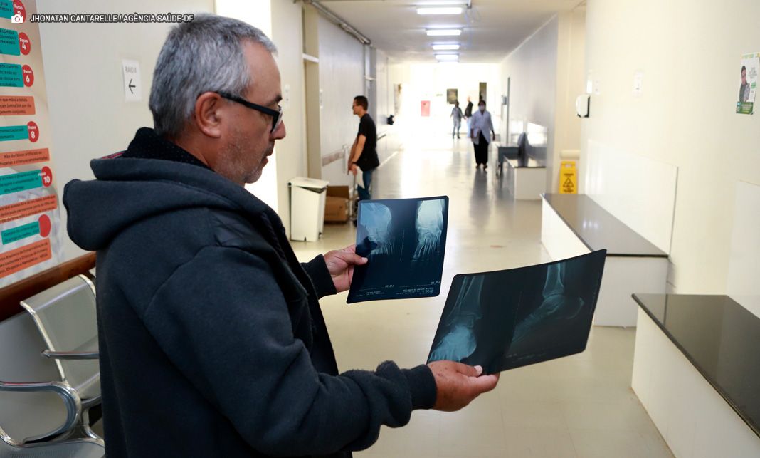 Hospital Regional de Planaltina amplia número de exames de imagem