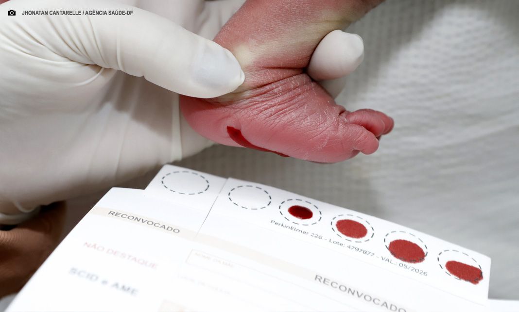 Teste do Pezinho: resultado garante saúde para Pedro Henrique e milhares de crianças no DF