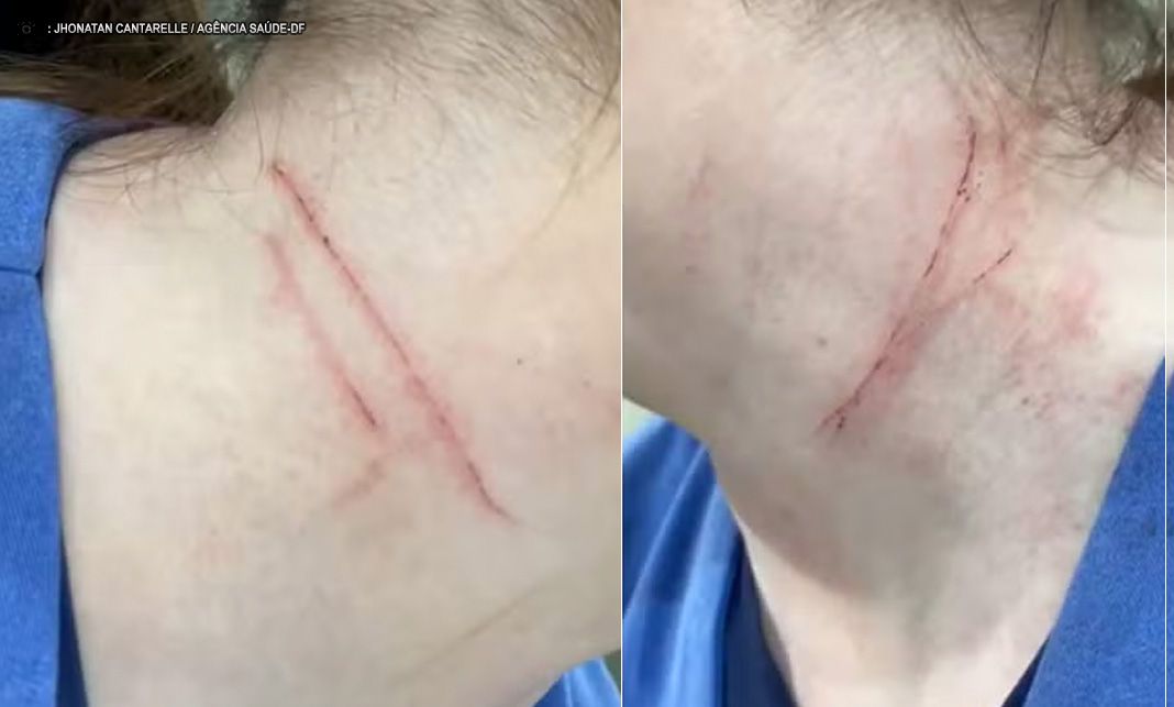 Técnica de Enfermagem e enfermeira são agredidas dentro de UPA em Jales