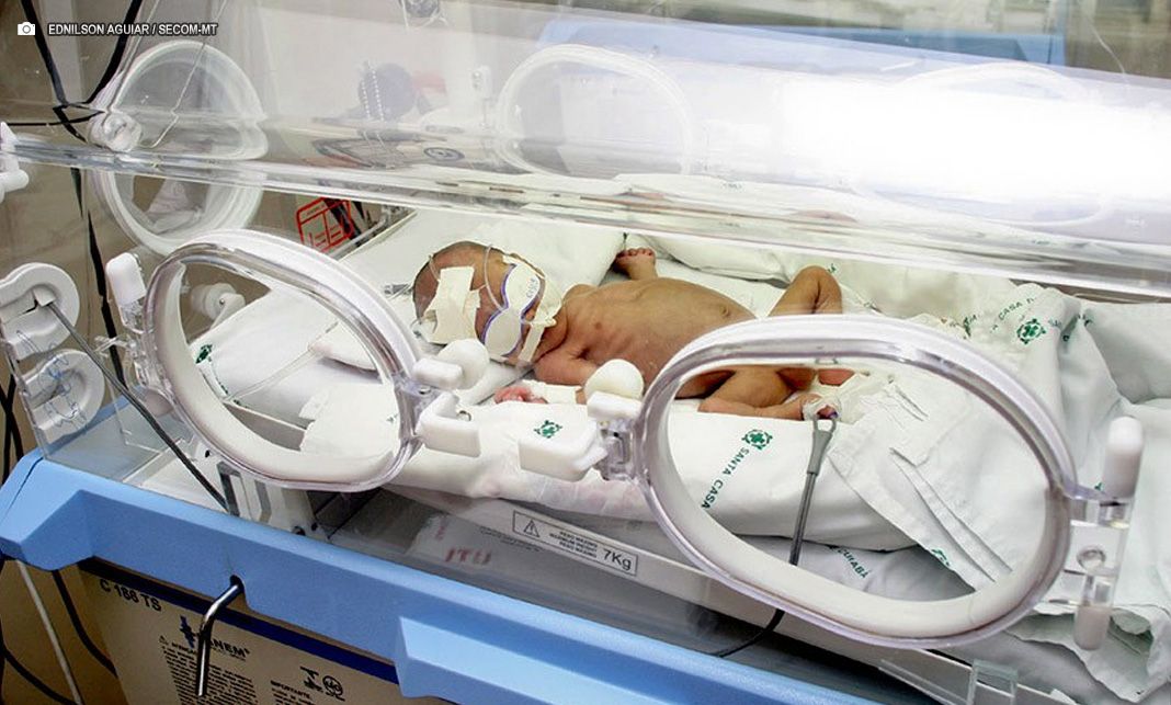 Projeto no Senado define acesso de bebês prematuros a vacinas no SUS