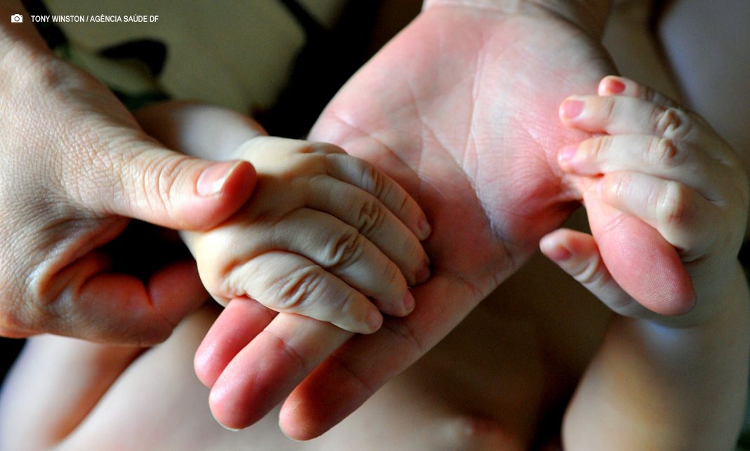 Doença mão-pé-boca: Pais devem redobrar atenção no ambiente escolar