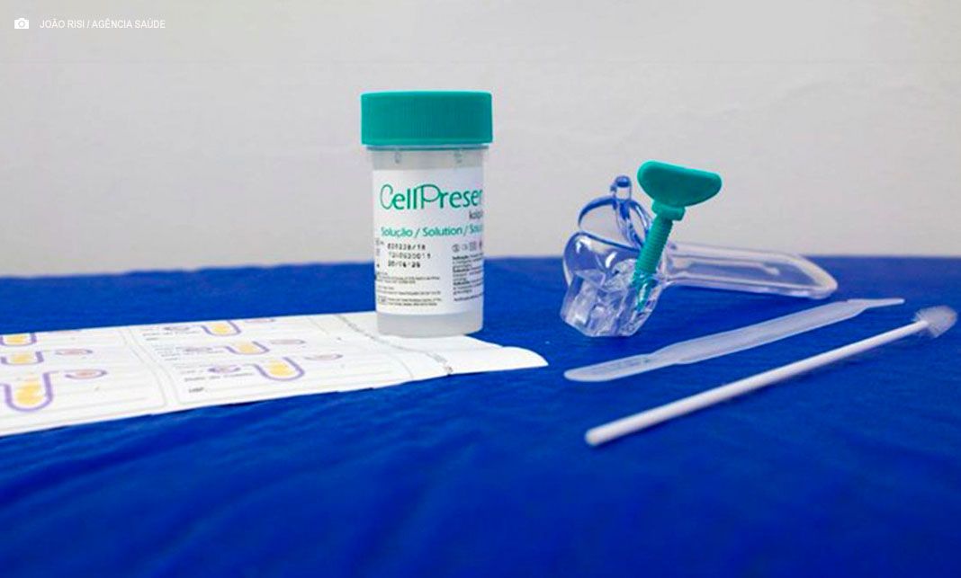 SUS adota novo teste para detecção precoce de câncer de colo do útero