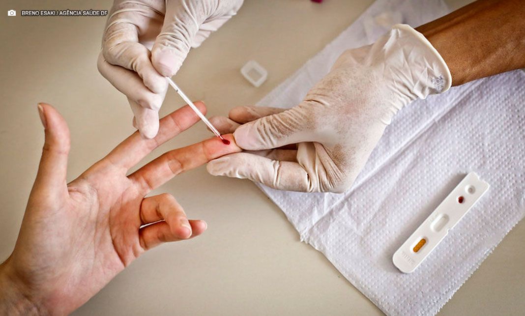 95% das testagem de sífilis no DF são realizadas em UBSs