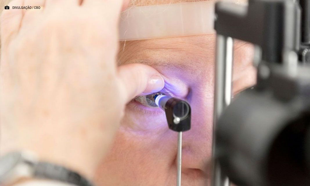 Saúde busca parceria para padronizar combate ao tracoma no Brasil