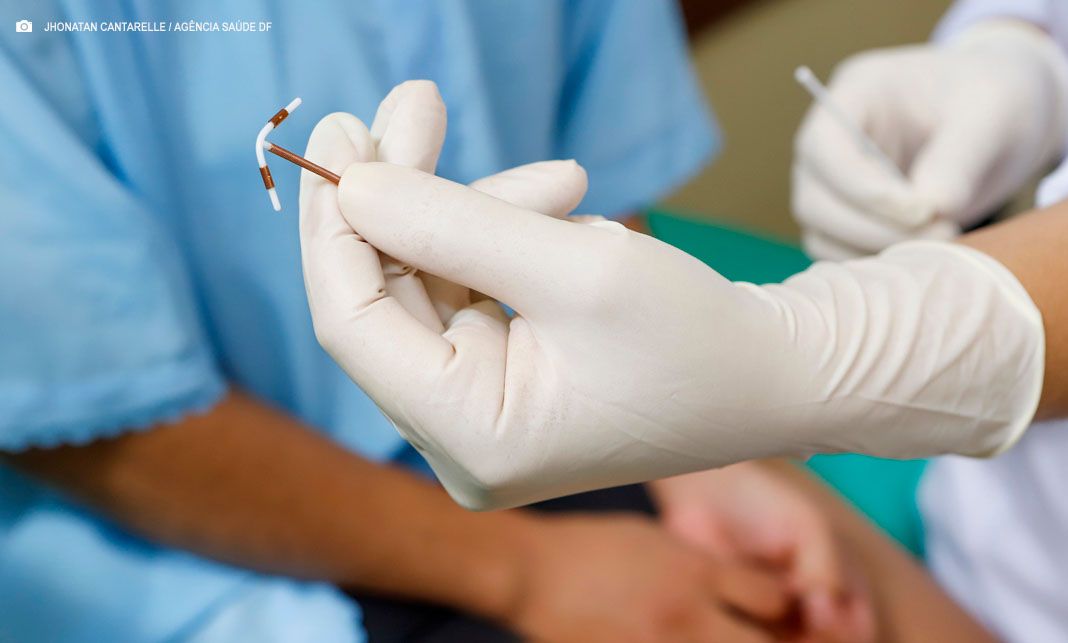 Força-tarefa da Saúde garante inserção de DIU a quase 600 mulheres