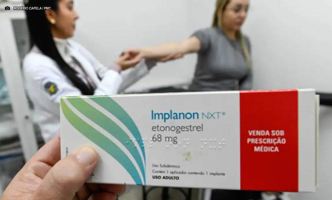 Planos de saúde são obrigados a cobrir implante contraceptivo
