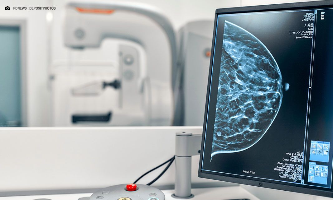 SUS amplia acesso à mamografia para mulheres a partir dos 40 anos