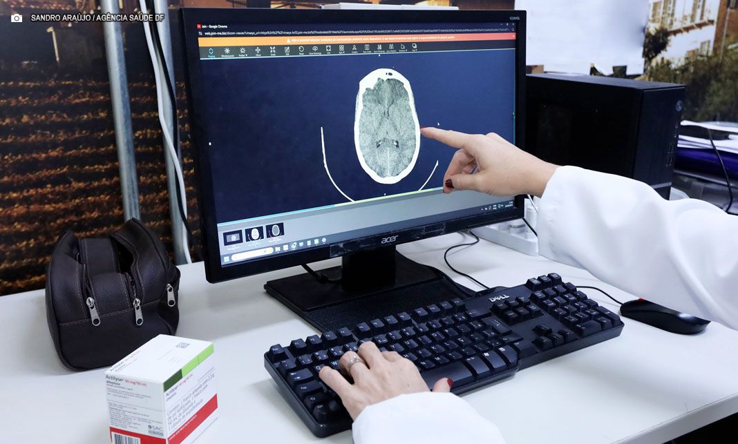 GDF reforça assistência emergencial ao Acidente Vascular Cerebral