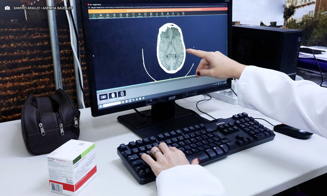 Programa ‘AVC no Quadrado’ descentraliza atendimento e amplia assistência no DF