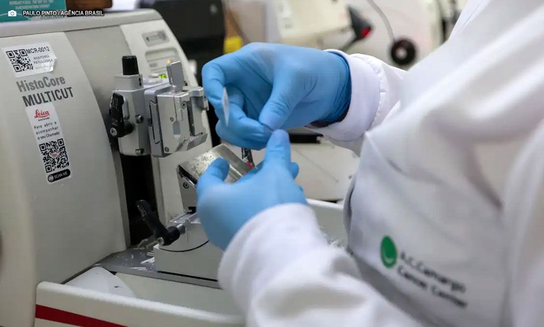 Estimativa de cura para câncer de próstata pode alcançar 98%