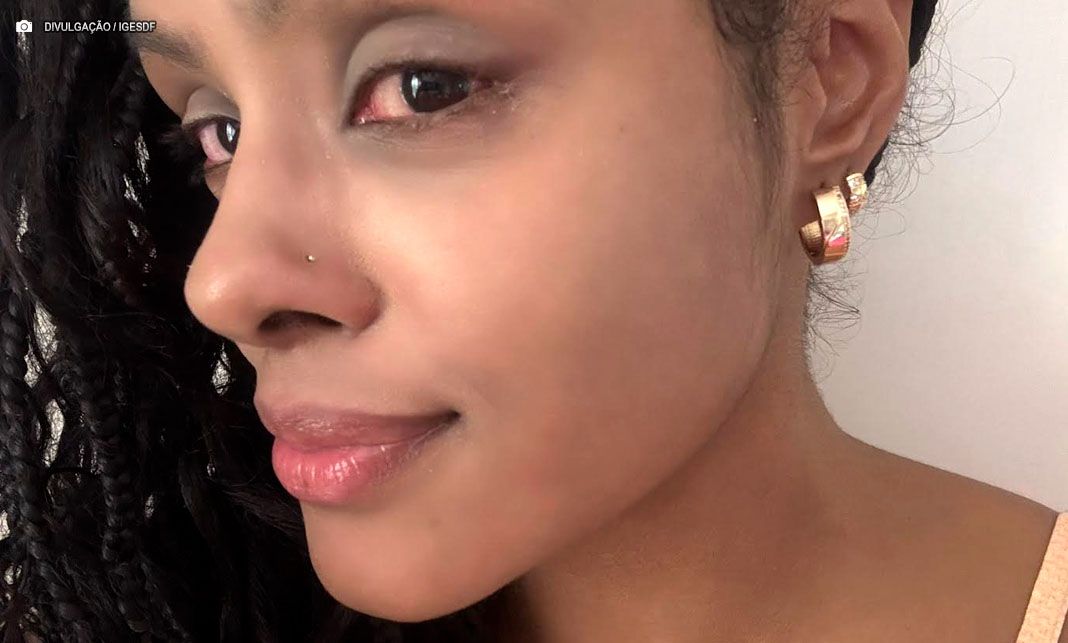 Olho vermelho? Atenção: a conjuntivite pode estar chegando