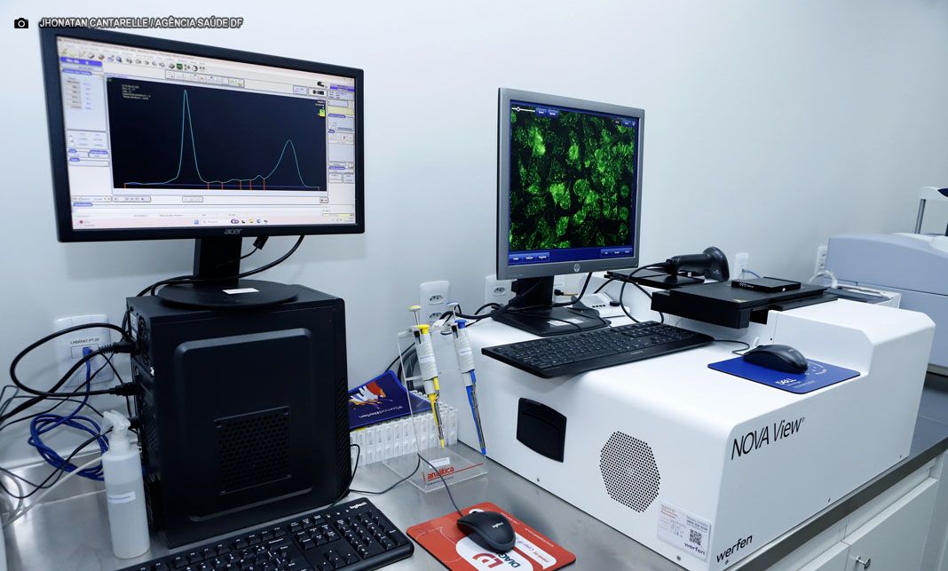 Central de Exames Especializados é inaugurada no Hospital Regional de Taguatinga