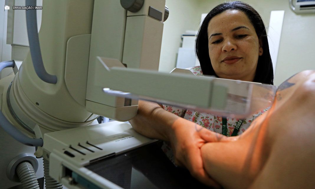 Mamografia: especialista esclarece mitos e verdades sobre o exame