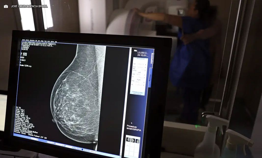 Outubro Rosa: Pacientes com câncer de mama têm direito a benefícios do INSS