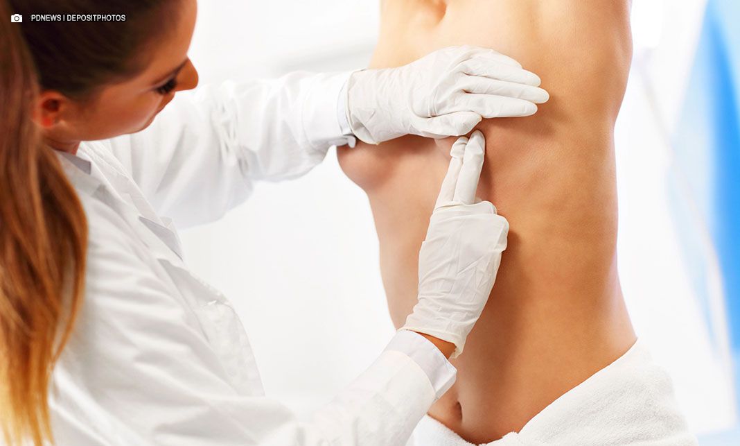 Pacientes submetidos a mastectomia passam a ter direito a assistência fisioterapêutica