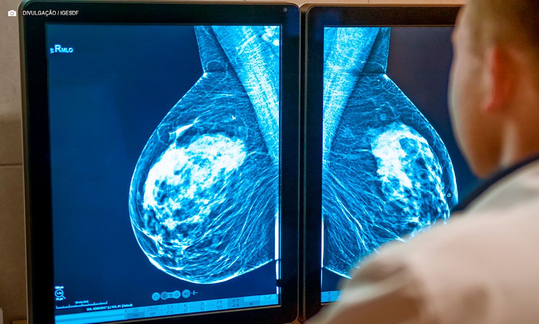 Dia Nacional de Combate ao Câncer alerta para estimativa de 704 mil novos casos em 2025