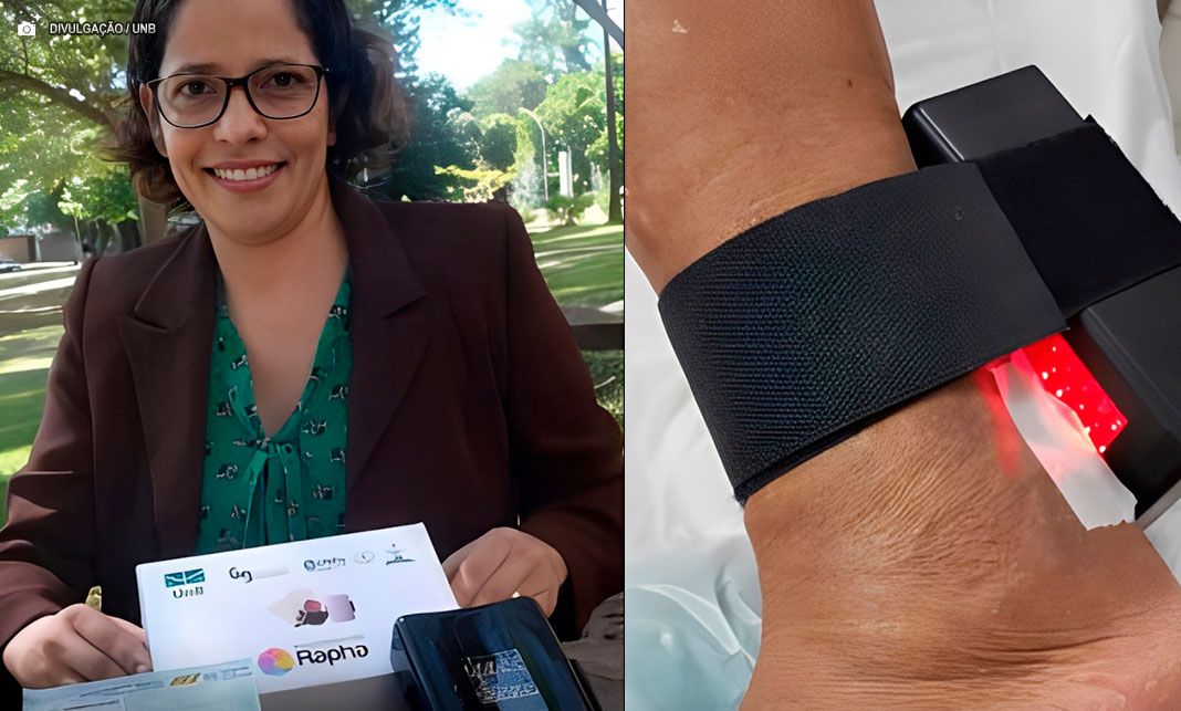 Pesquisa da UnB desenvolve dispositivo com látex e LED para evitar amputações por pé diabético