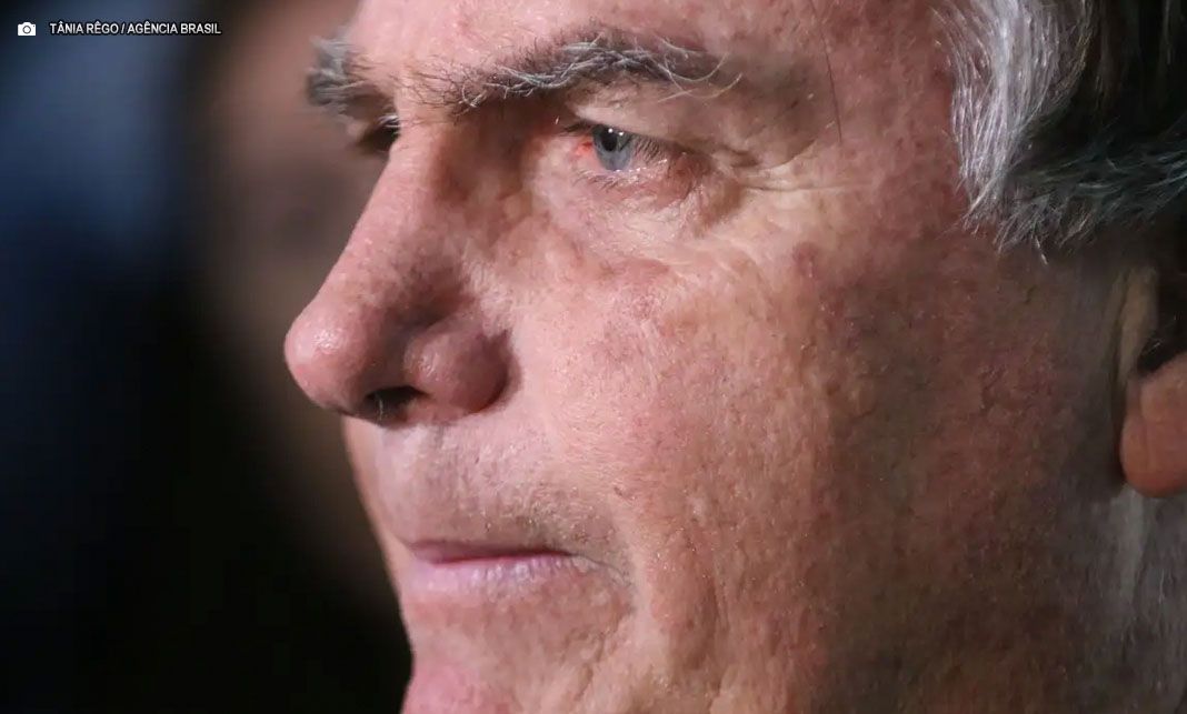 Jair Bolsonaro passa por quarta cirurgia após nova crise de soluços