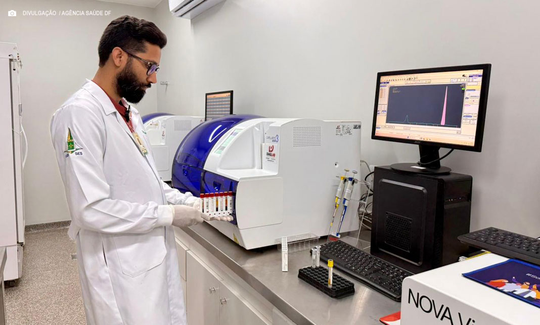 Eletroforese capilar: Saúde do DF implanta novo exame de sangue na rede pública