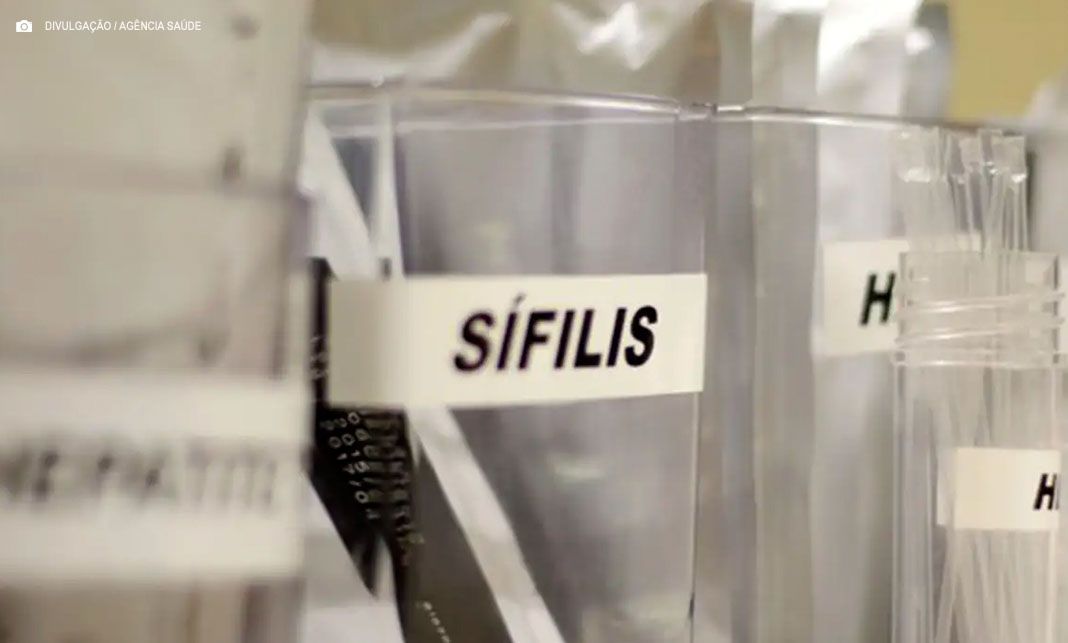 Sífilis acelera crescimento no país e atinge jovens e gestantes