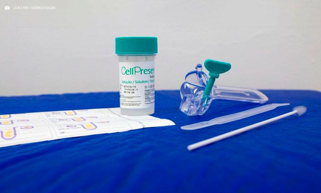 Guia orienta sobre transição no rastreamento do câncer de colo do útero