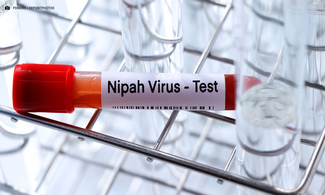 Ministério da Saúde descarta ameaça do vírus Nipah para o Brasil