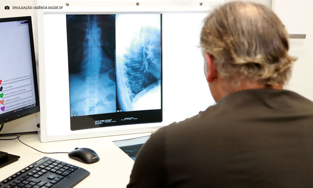 Saúde debate padronização de equipamentos de raio-X digital no DF