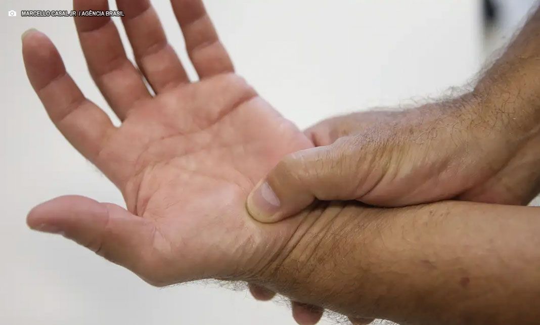 Governo federal amplia tratamento de fibromialgia no SUS com novas diretrizes