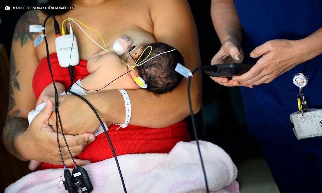 Hospital Regional do Gama implementa exame auditivo detalhado para recém-nascidos