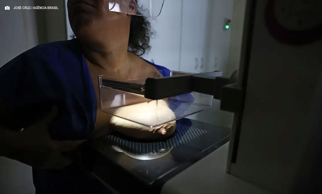 Câncer de Mama: 92% das brasileiras entre 50 e 69 anos fizeram mamografia