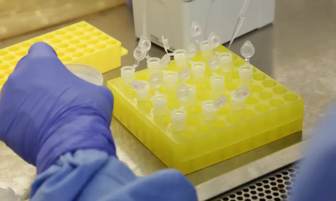 SP confirma segundo caso importado de sarampo em quatro meses SP confirma segundo caso importado de sarampo em quatro meses