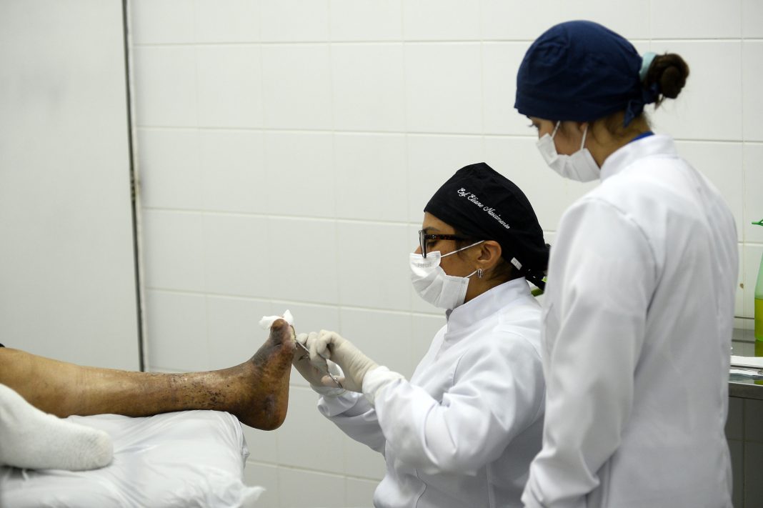 Diabetes é a principal causa de amputações no Brasil Diabetes é a principal causa de amputações no Brasil