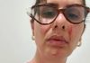 Enfermeira é agredida dentro do hospital de Samambaia. Jorge Vianna pede providências