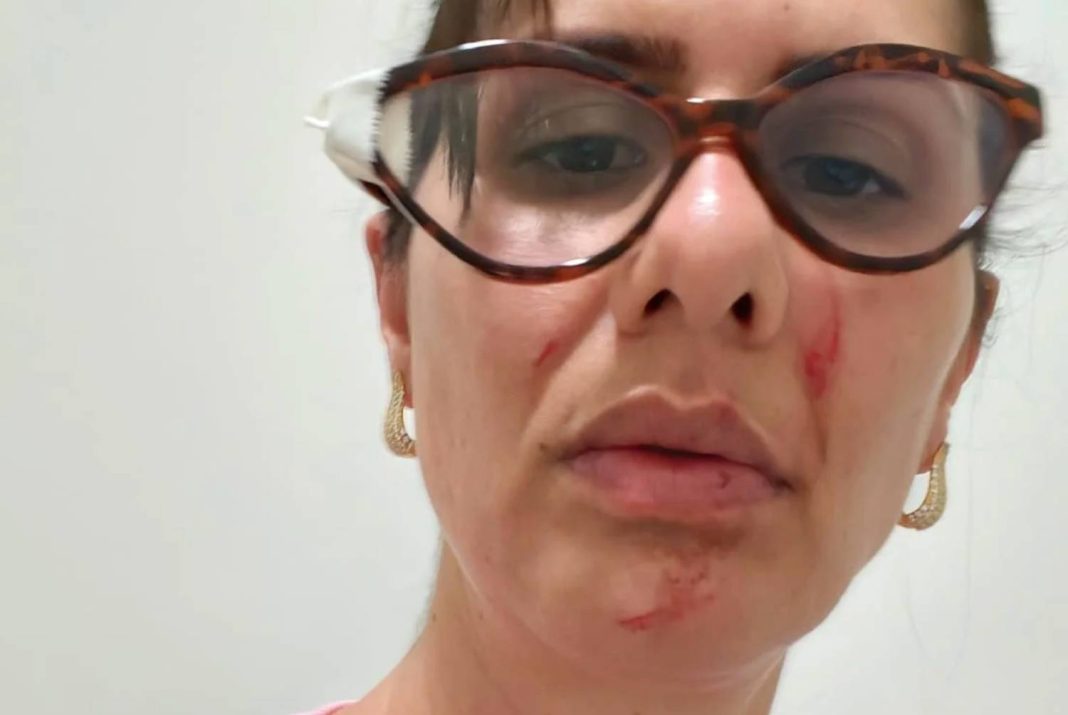 Enfermeira é agredida dentro do hospital de Samambaia. Jorge Vianna pede providências Enfermeira é agredida dentro do hospital de Samambaia. Jorge Vianna pede providências
