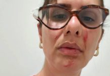 Enfermeira é agredida dentro do hospital de Samambaia. Jorge Vianna pede providências