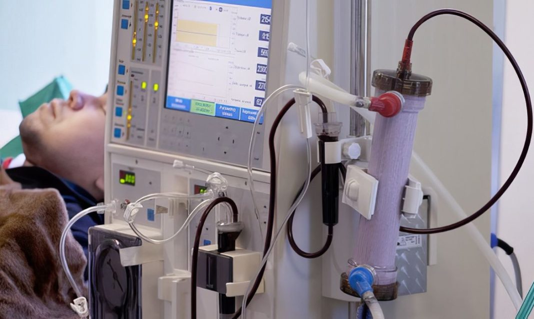 Estudo alerta para subdiagnóstico da doença renal crônica no Brasil Estudo alerta para subdiagnóstico da doença renal crônica no Brasil