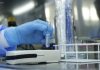 Saúde do DF conta com exame para auxilio de diagnóstico de meningite bacteriana