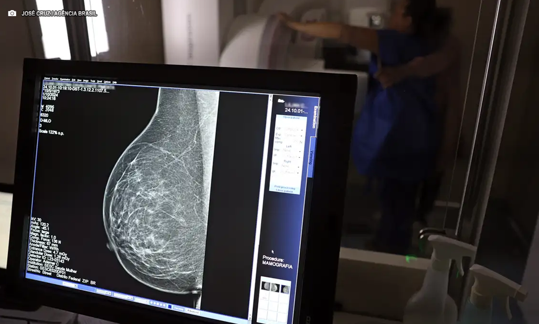 Médicos lançam guia para evitar recusa de mamografia digital Médicos lançam guia para evitar recusa de mamografia digital