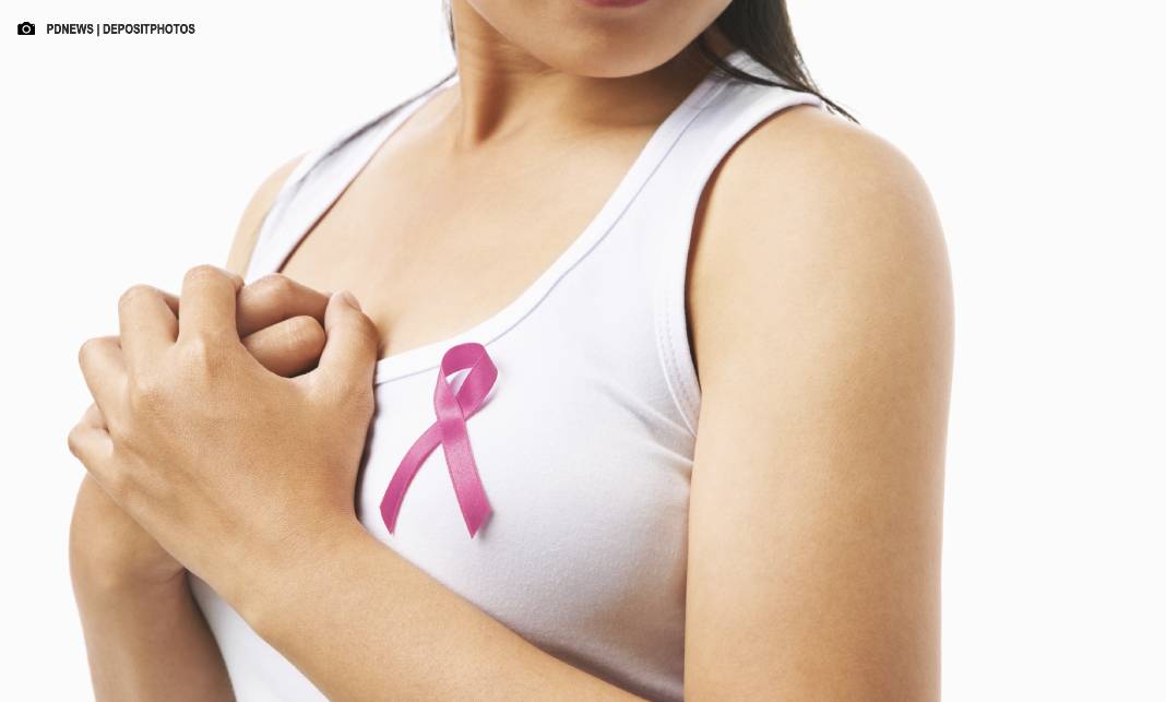Teste genético personaliza prevenção e cuidado no combate ao câncer de mama Teste genético personaliza prevenção e cuidado no combate ao câncer de mama